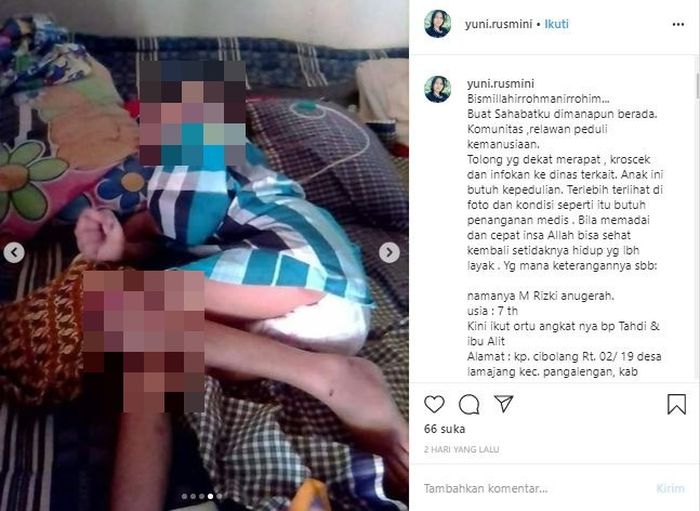 Postingan viral kondisi erkini Rizki Anugrah yang kehilangan ingatan dan buta usai dianiaya orang tua.