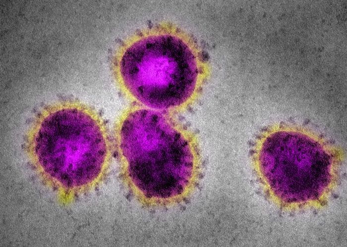 Virus ini telah membunuh 41 orang di China dan menginfeksi lebih dari 1.300 orang lainnya