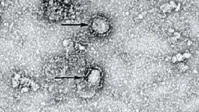 Penampakan virus corona.