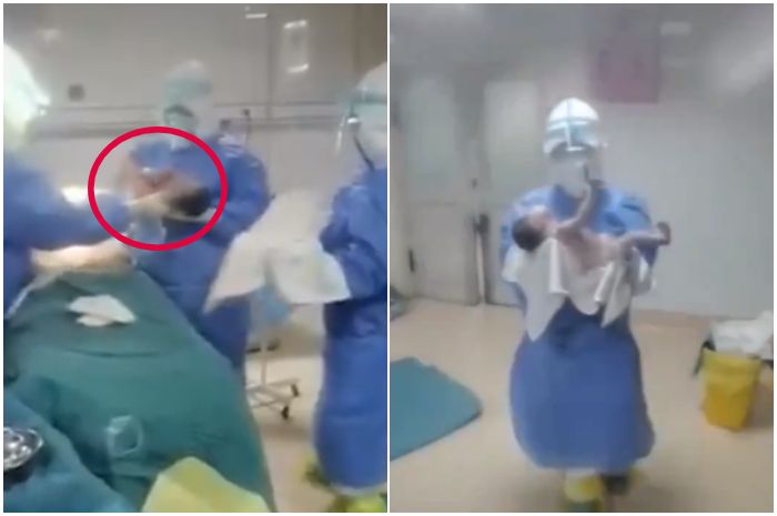 Kondisi bayi Xiaoyan yang dilahirkan saat sang ibu terinfeksi virus Corona