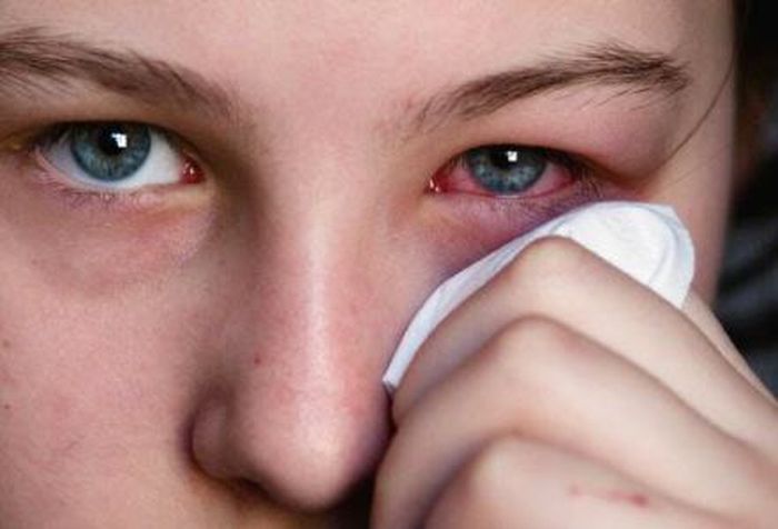 Virus Corona Menyasar Sistem Saraf, Pasien Covid-19