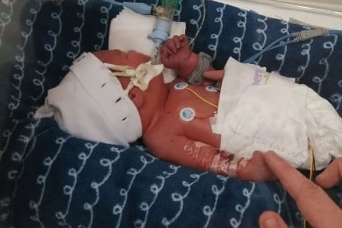 Kisahnyata Mesum Di Gubuk VIRAL Hanya Bertahan Sehari Bayi Putri Duyung Ini Kisahnyata Mesum Di Gubuk VIRAL Hanya Bertahan Sehari Bayi Putri Duyung Ini