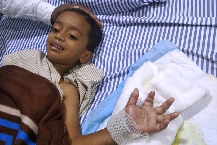Shaurya setelah operasi