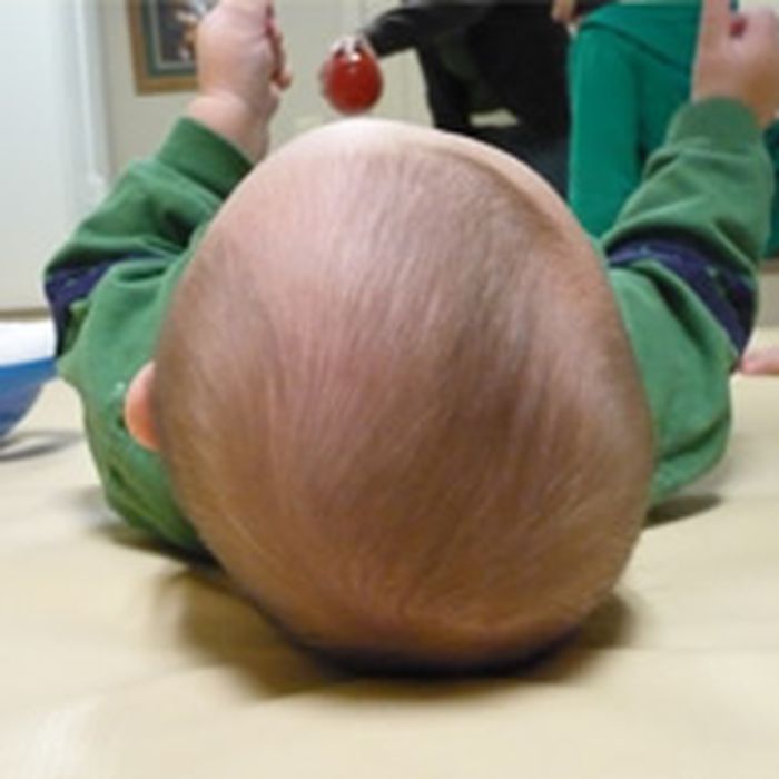 Bentuk Kepala Bayi Bagus Sehat Dan Normal Begini Cara Ceknya Mudah Moms Semua Halaman Nakita