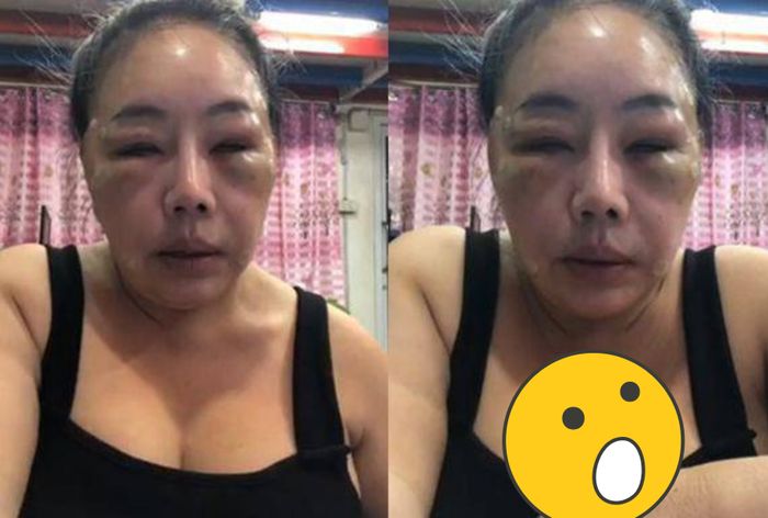 Wabahnya ketika terlihat bengkak.