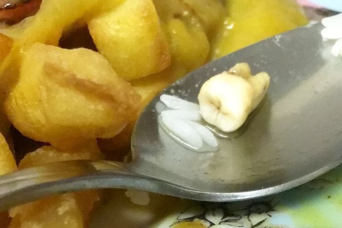 Seorang pria temukan gigi di dalam menu kari yang dimakannya di sebuah restoran