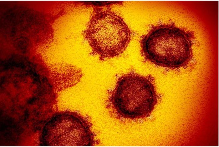 Virus Corona