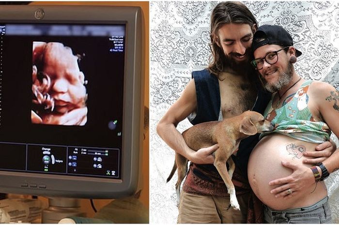 Lelaki ini hamil anak lelaki. Bagaimana ini terjadi?