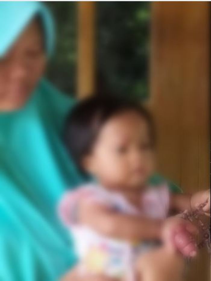 Etik Susilowati dan anaknya Samara Kumaira Mariba yang jari tangan kanannya mengalami bengkak setelah digigit kutu kucing di Sragen, Jawa Tengah.