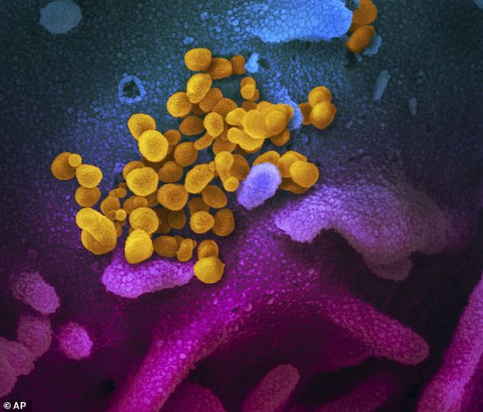 Virus Corona (kuning) yang tersusun dari partikel lebih tipis daripada partikel penyusun jaringan tubuh manusia dan hewan (warna pink dan biru)