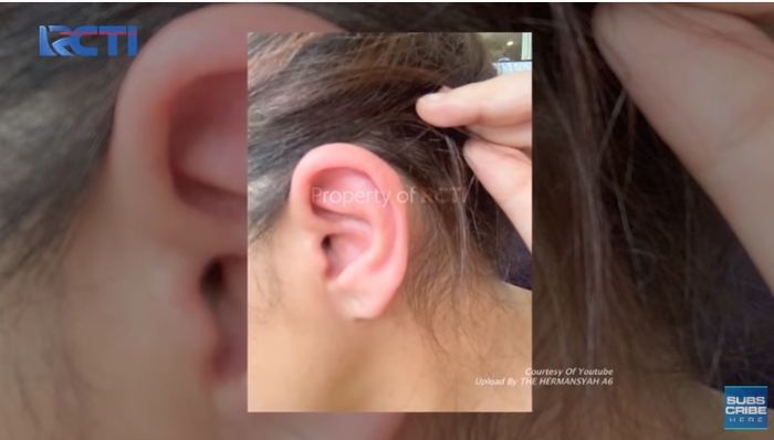 Autoimun <a href='https://pontianak.tribunnews.com/tag/ashanty' title='Ashanty'>Ashanty</a> dikabarkan kambuh