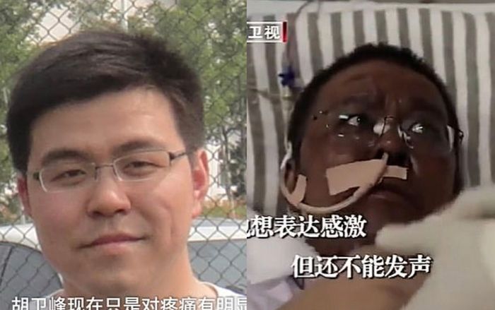 Kulit Dokter Hu <a href='https://style.tribunnews.com/tag/weifeng' title='Weifeng'>Weifeng</a> juga berubah menjadi <a href='https://style.tribunnews.com/tag/hitam' title='hitam'>hitam</a> setelah perawatan corona