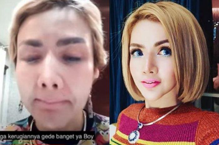 Perbedaan wajah polos Barbie Kumalasari dan saat mengenakan make up.