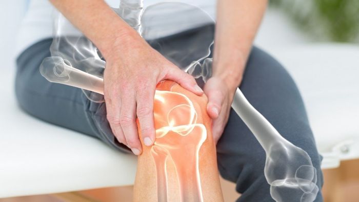 Ilustrasi osteoporosis