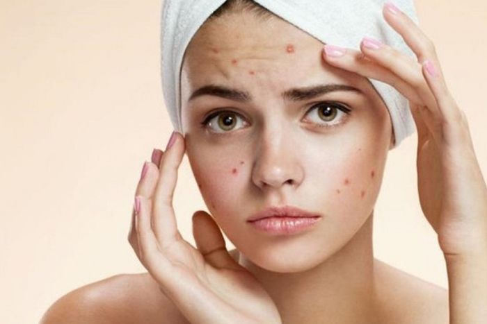 Rekomendasi Skincare Remaja