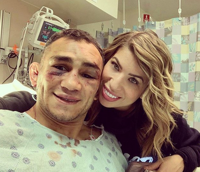 Tony Ferguson (kiri) dengan luka robek dibawah matanya pasca UFC 249 tengah berfoto bersama sang Istri. 
