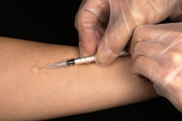 Vaksin virus corona sudah memasuki tahap 3 uji coba.