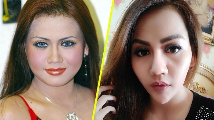 Nita Thalia sebelum dan sesudah <a href='https://manado.tribunnews.com/tag/operasi-plastik' title='operasi plastik'>operasi plastik</a>