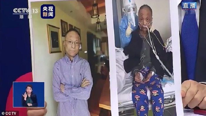 Dr <a href='https://style.tribunnews.com/tag/yi-fan' title='Yi Fan'>Yi Fan</a> pada 9 Mei (kiri) dan pada 6 April (kanan)