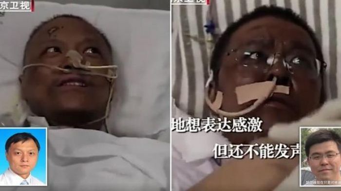 Dua dokter asal Wuhan, China Dr Yi Fan dan Dr Hu Weifeng yang kritis setelah mengidap Covid-19 menemukan kulit mereka berubah warna