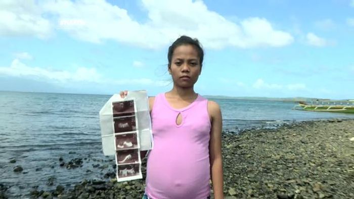 Kimberly menunjukkan hasil USG