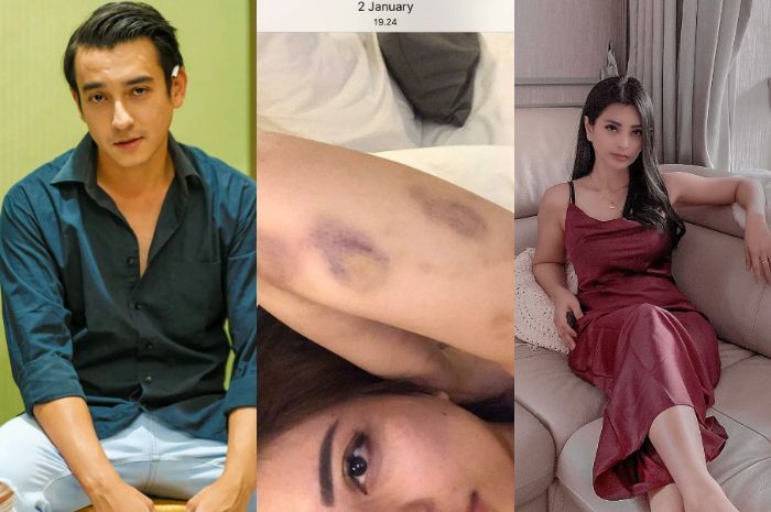 Terungkap Aliff Ali kerap melakukan KDRT terhadap Aska Ongi.