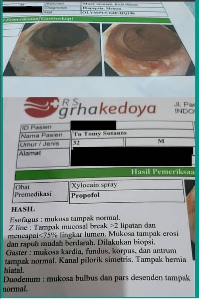 Hasil pemeriksaan pria yang sering makan mi instan setengah kardus dalam seminggu