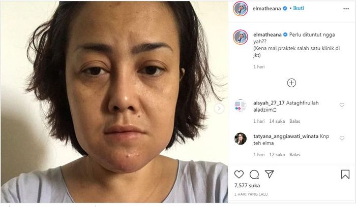 Rency Milano mengalami malpraktek sebuah klinik di Jakarta.