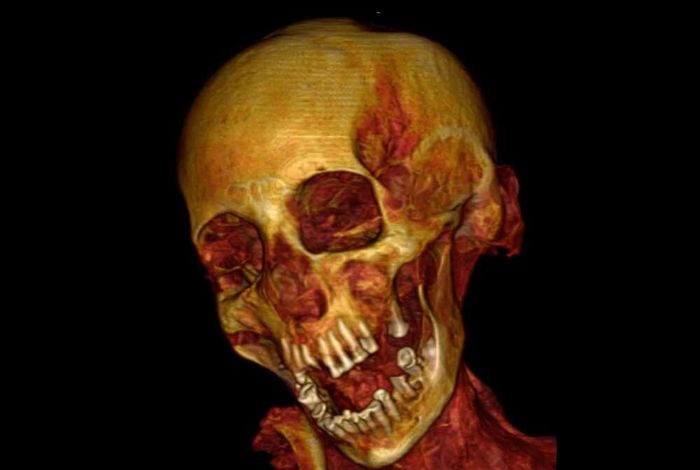 Tengkorak 'mumi wanita menjerit'.