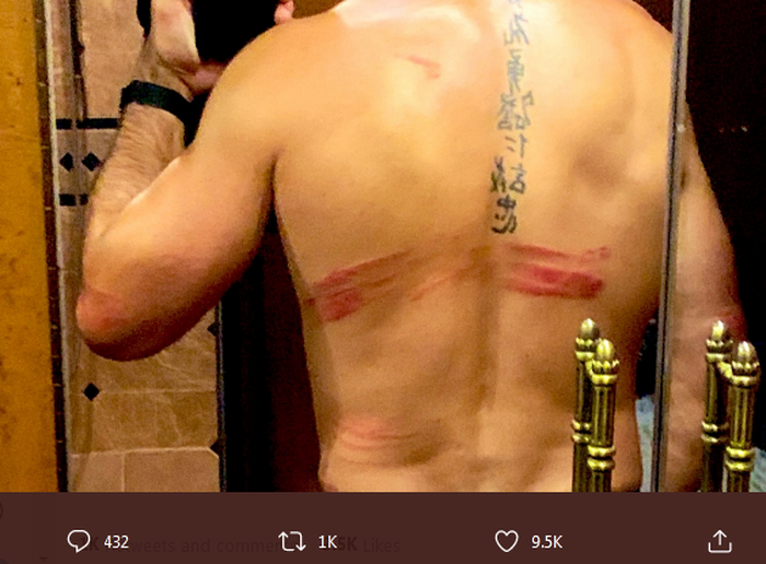 Potret punggung bintang WWE, Seth Rollins setelah ditebas dengan pedang kendo oleh, putra Rey Mysterio, Dominik Mysterio.