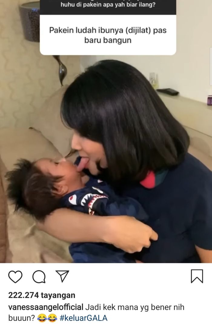 Vanessa Angel yang sedang menjilati pipi anaknya untuk menghilangkan ruam wajah.