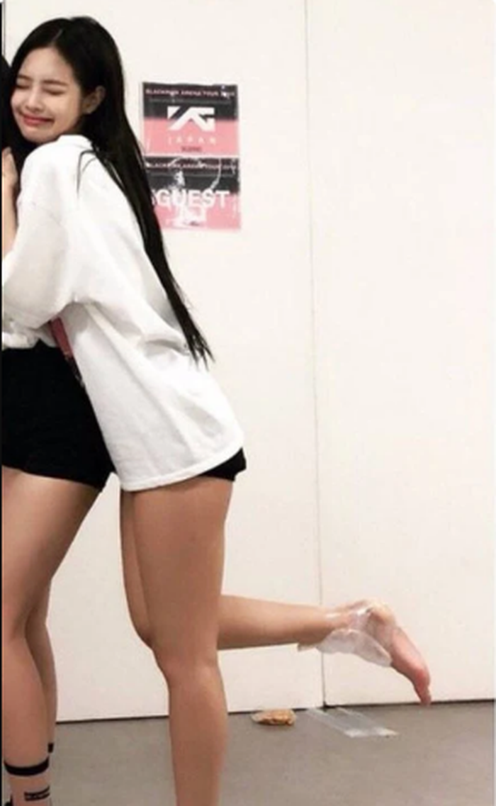 Jennie yang pergelangan kakinya terluka saat konser di Jepang