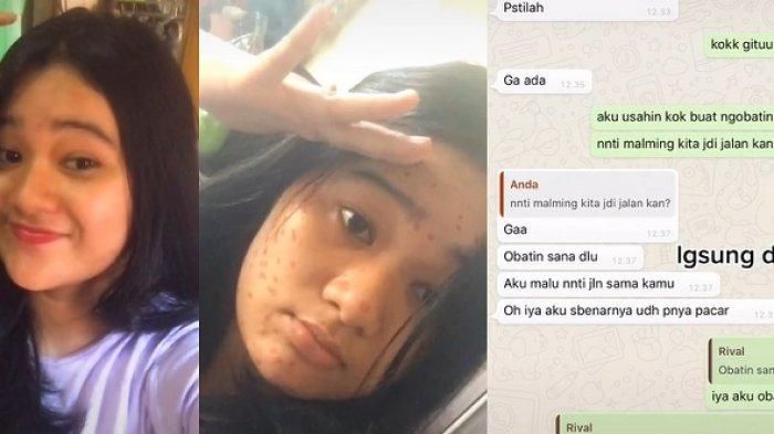 Kisah wanita viral ditinggal gebetan setelah prank tunjukkan wajah berjerawat