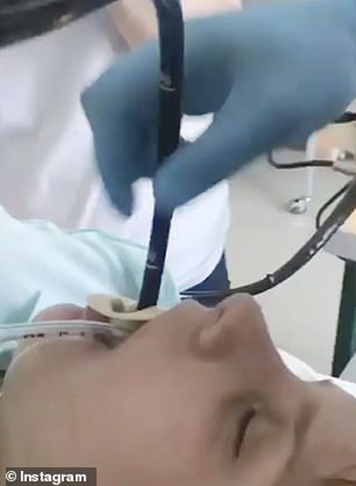 Detik-detik saat dokter memasukkan selang ke dalam mulut pasien.