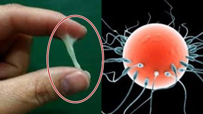 Ilustrasi sperma