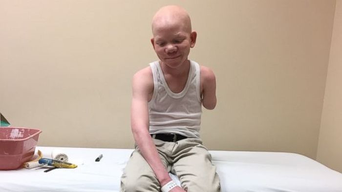 Mwigulu saat berusia 14 tahun dari Tanzania