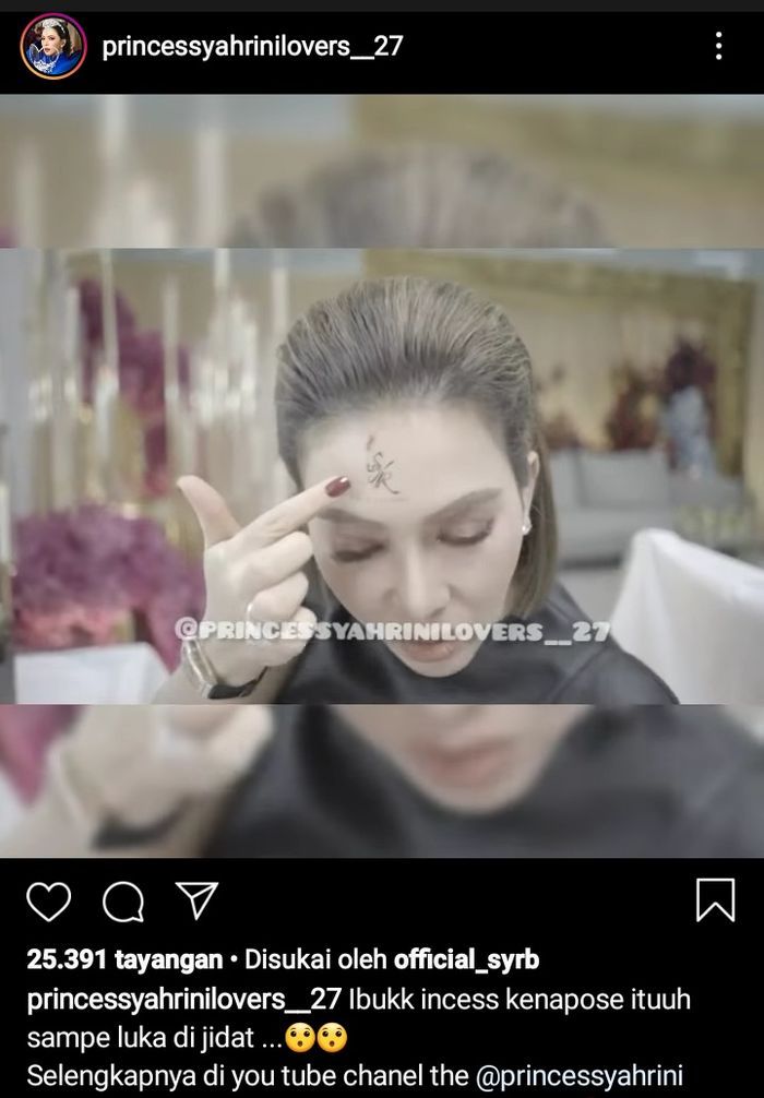 Luka di kening Syahrini