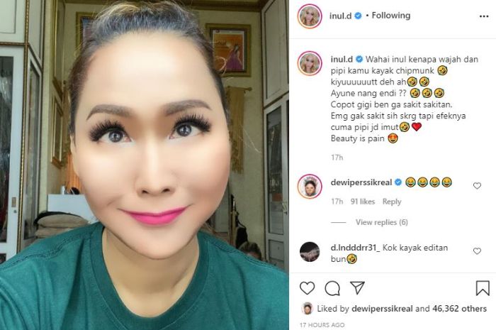 Wajah Inul Daratista yang begitu tembem.