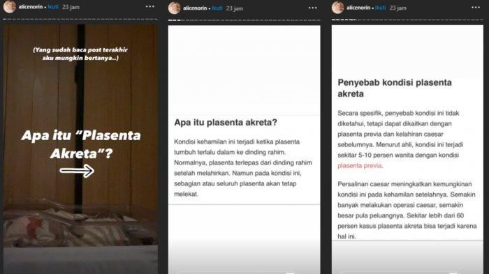Alice Norin ungkap perjuangannya melahirkan