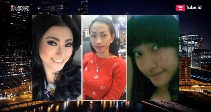 Metamorfosa wajah Amel Alvi