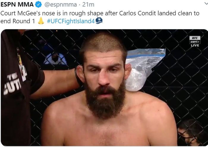 Hidung Court McGee penyok dihajar Carlos Condit di UFC Fight Island 4, Minggu (4/10/2020).