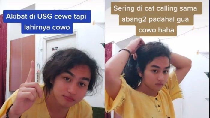 Viral kisah laki-laki yang lahir hasil USG perempuan, disebut lebih cantik dari perempuan asli hingga dapat catcalling dari pria.