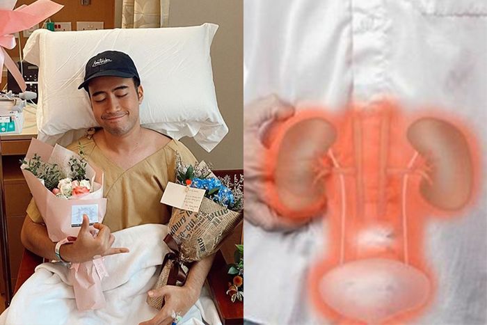 Vidi Aldiano yang pernah mengalami kanker ginjal