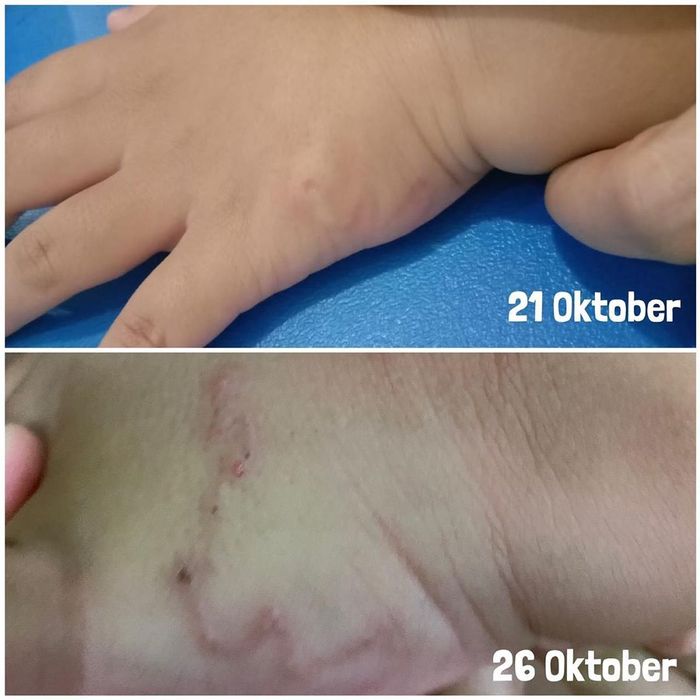 Anak kedua Anji, Sigra kemasukan larva cacing tambang saat bermain pasir