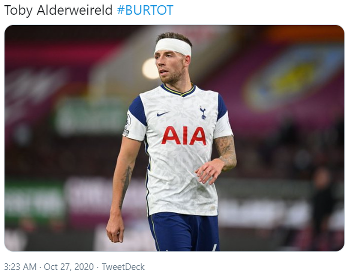 Toby Alderweireld harus melanjutkan pertandingan usai tersikut saat berduel dengan Ashley Barnes di udara dalam laga Burnley kontra Tottenham Hotspur di pekan ke-6 Liga Inggris 2020-2021.