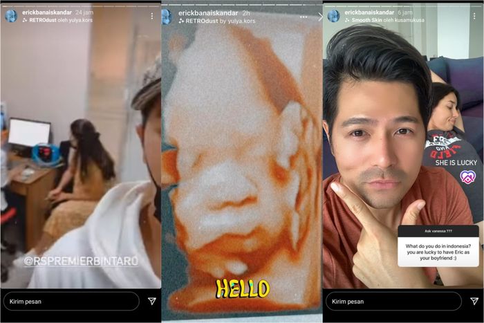Erick Iskandar pamer hasil USG