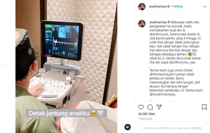 Hamil anak pertama, Audi Marissa nangis di depan dokter usai dengar detak jantung janinnya.