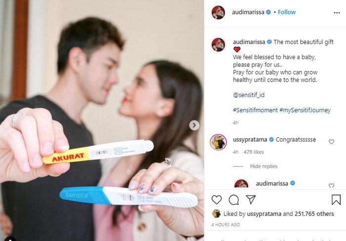 Hamil anak pertama, Audi Marissa nangis di depan dokter usai dengar detak jantung janinnya.