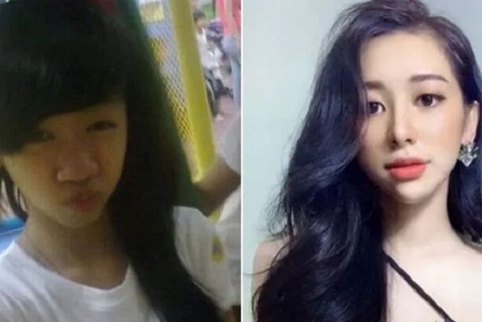 Perbedaan Nguyen sebelum dan sesudah operasi plastik (Oddity Central)