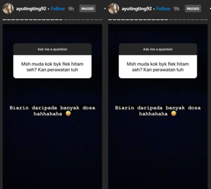 Tanggapan santai Ayu Ting Ting kepada netizen yang nyinyirin kondisi wajahnya dengan flek hitam